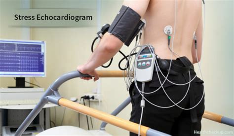 Stress Echocardiography: Purpose, Procedure, and Results.